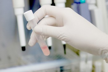 Blood Test Laboratory In Melbourne