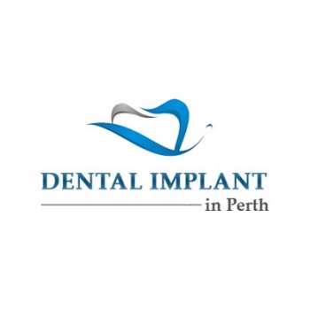 All on 4 Dental Implants Balcatta WA