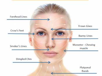 Anti-Wrinkle Injection is available at Box Hill Superclinic