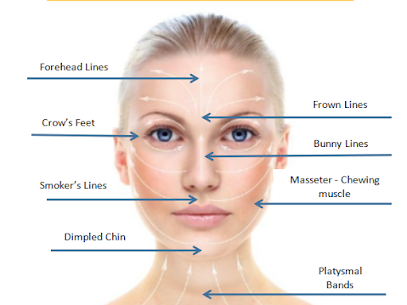 Anti-Wrinkle Injection is available at Box Hill Superclinic