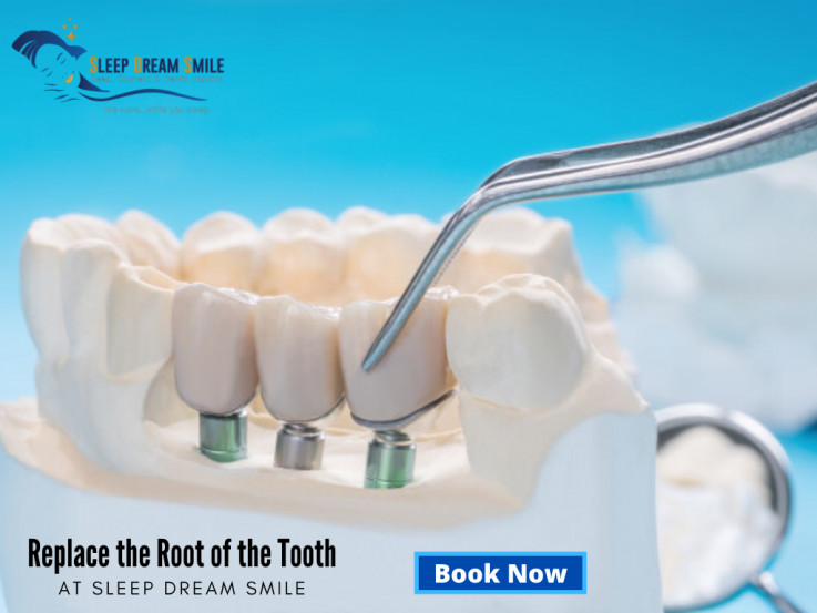 Affordable, Permanent and Predictable Teeth Replacement Solution in Melbourne