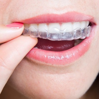 Keep your teeth clean at our dental clinic in Dandenong