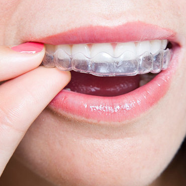 Keep your teeth clean at our dental clinic in Dandenong