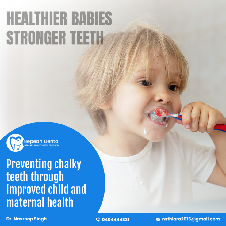 All On 4 Dental Implants Sydney | Penrith Dentist | All on 4 clinic sydney