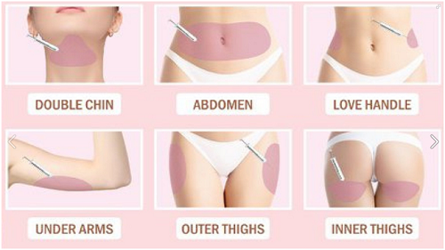 non surgical fat removal cost