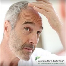 Get the Best Hair Loss Treatment in Brisbane