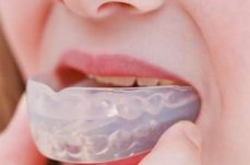When Should You Consider Wearing A Mouthguard?