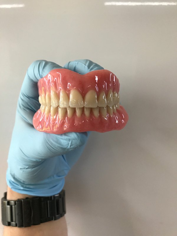 Best Dentures in Penrith and Blue Mountains 