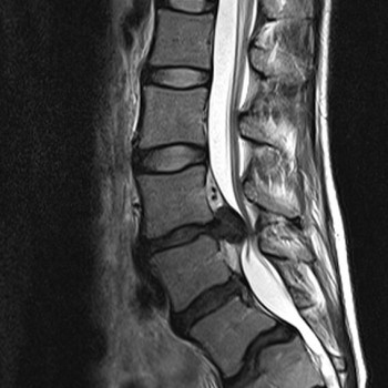 Contact us for World-class Spinal Neurosurgery in Melbourne