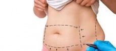 Safer and Effective Liposuction Procedure in Melbourne From Chelsea Cosmetics!