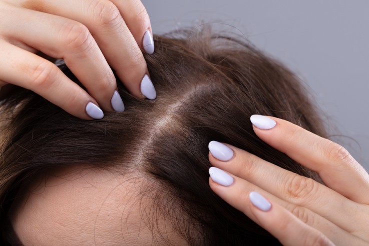 Get a Best Cool Look With Hair Coloring Narre Warren