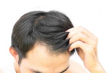 Looking for Treatment for Hair Growth?