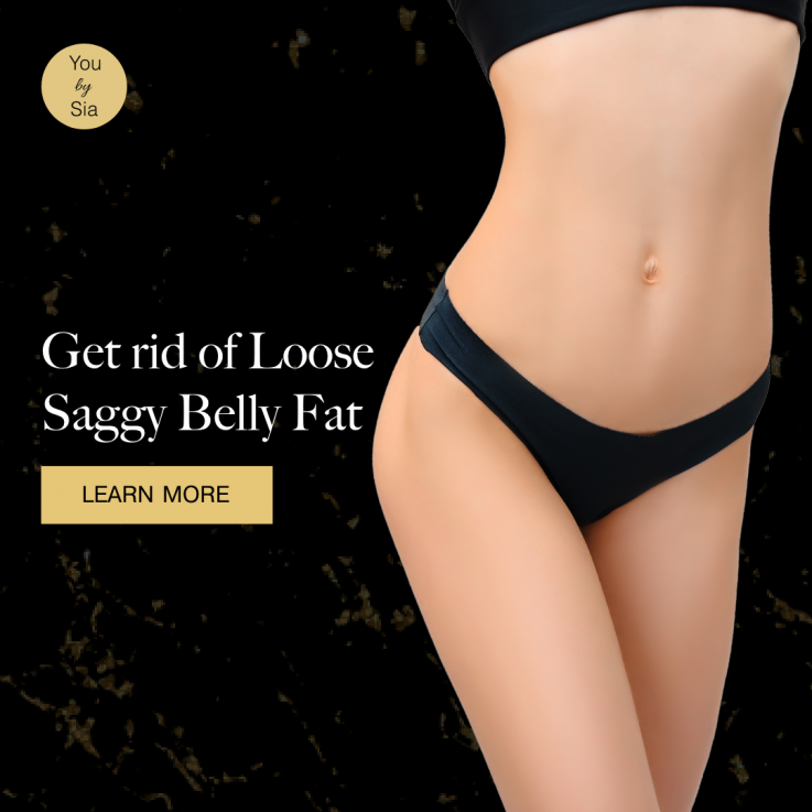 Laser Skin Tightening Treatment for Loose and Saggy Tummy!