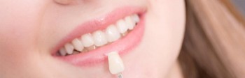 Porcelain Dental Veneers | Hawthorn East Dental
