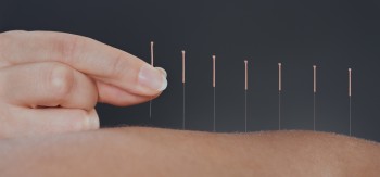 Acupuncture Bayside - BalanceMed.com.au