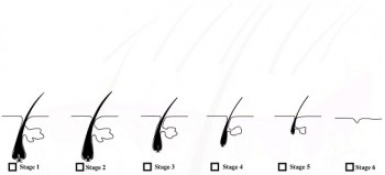 How to grow your hair naturally? 