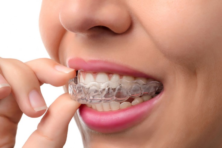 North Rocks Dentist 
