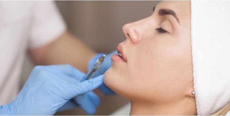 Lip Fillers Adelaide