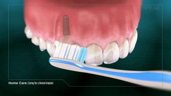 Complete Dental Oral Surgery and Implants