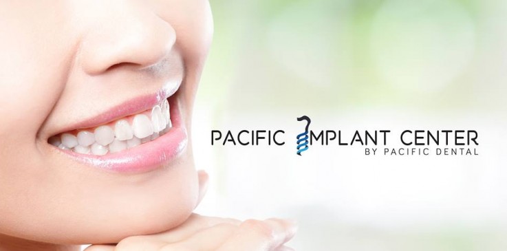 Cosmetic Dentistry Mexico - Pacific Impl