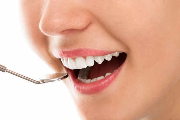Newcastle Teeth Whitening Dentist