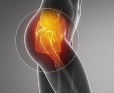 Hip Injection - Treatment for Early Hip Arthritis | PJS Orthopaedics