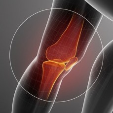 Hip Injection - Treatment for Early Hip Arthritis | PJS Orthopaedics