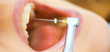Root Canal Treatment in Seville, Victoria