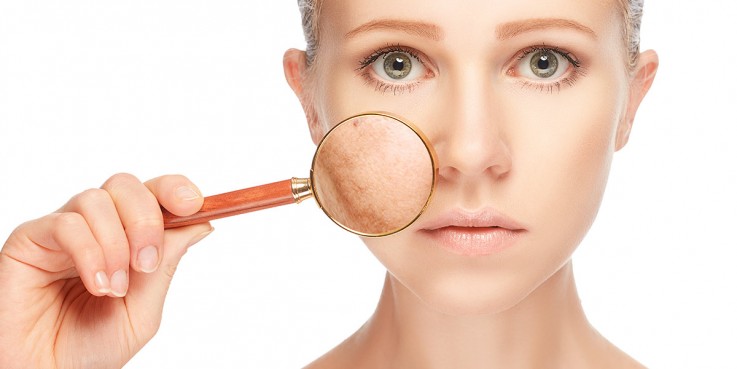 Skin pigmentation treatment Adelaide