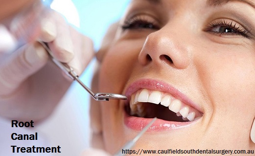 Save Your Teeth with Root Canal Treatment in Melbourne