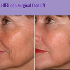 Simetics Beauty and Laser Clinics