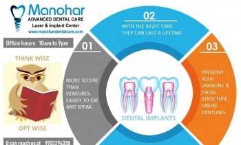 teeth whitening doctor in vizag |Manohar dental care 