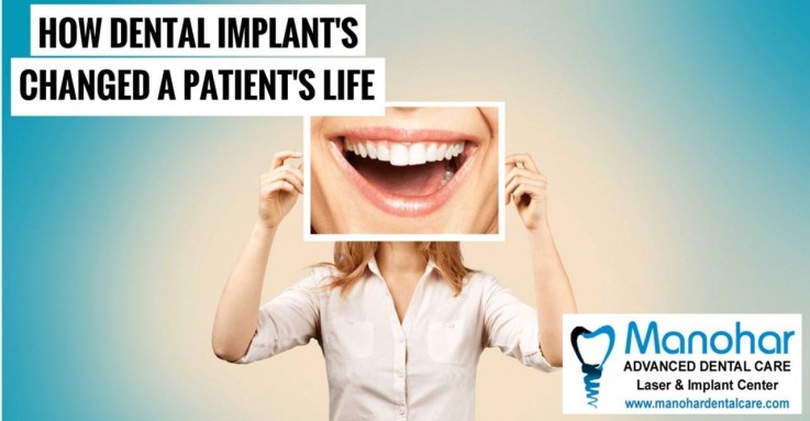 best gum disease treatment in vizag 