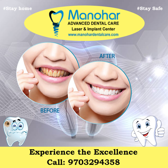 teeth whitening doctor in vizag |Manohar dental care 