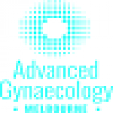 fibroid pain symptoms