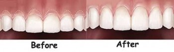 Best Laser Dental Clinic