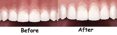 Best Laser Dental Clinic