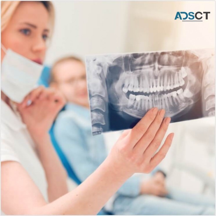 Professional Wisdom Teeth Removal In Dandenong