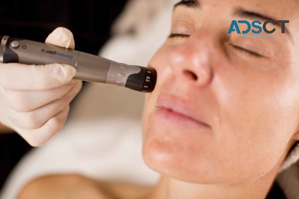 Medical Needling Treatment Coogee