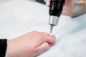 Best Laser Tattoo Removal Sydney