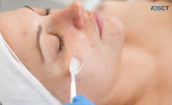 Cosmedix Benefit Peel Treatment 