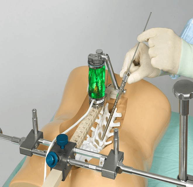 Robotic Spinal Surgeries-Making Safer And More Precise