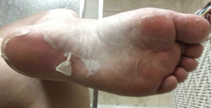 Buy Foot Care Products Online | feetretreat.shop