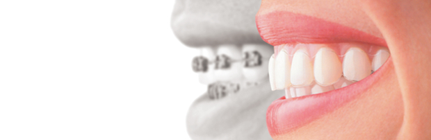 Orthodontist Dandenong | Dandenong Orthodontics