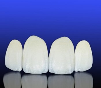Porcelain Veneers Melbourne | Prahran Family Dental
