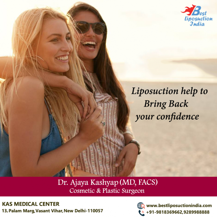  Chin Liposuction Surgery in India