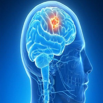 Qualified and Experienced Neurosurgery Consultant