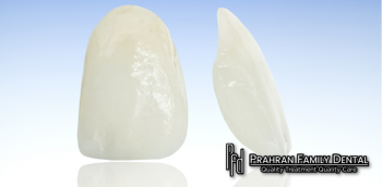Porcelain Veneers Melbourne | Prahran Family Dental