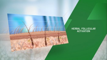 Do You Need a Good Hair Treatment Option in Sydney?