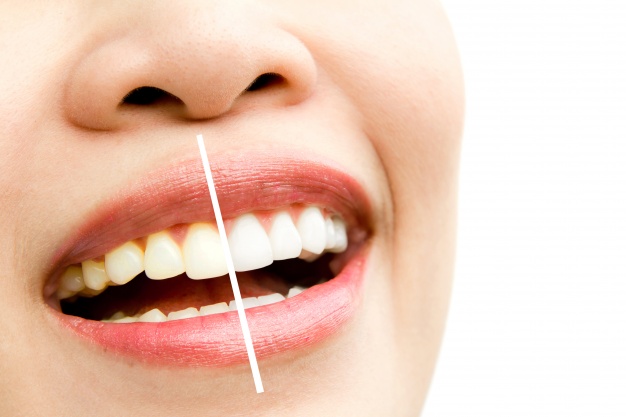 Wisdom Teeth Removal Dentist | Wisdomteethdoctors 